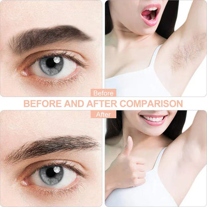 FLAWLESS HAIR REMOVER